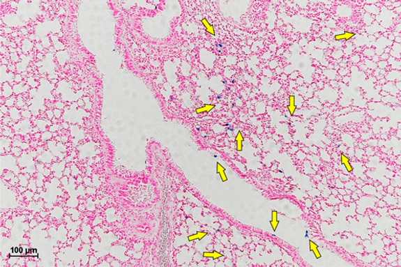Optical microscopy - lung tissue G4, 30 days
