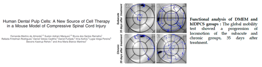 Murine Model of Huntington's Disease